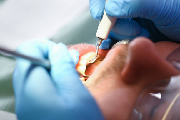 Best Emergency Root Canal Treatment in Abram, TX