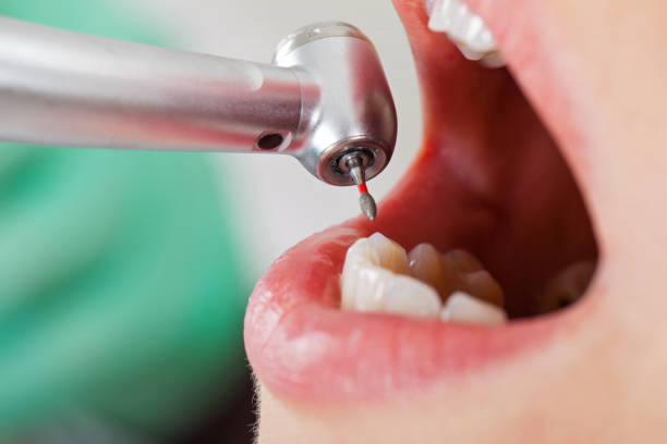 Best Mobile Emergency Dentist in Abram, TX